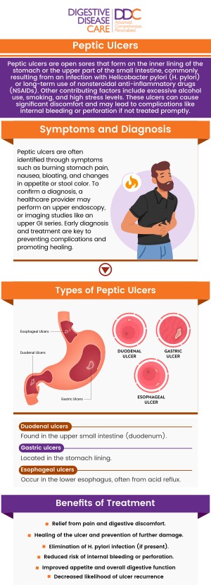 At Digestive Disease Care (DDC), our board-certified gastroenterologists have abundant experience and expertise in treating peptic ulcers. Please contact us for more information or request an appointment online. We have convenient locations to serve you in Babylon NY, East Setauket NY, Forest Hills NY, Jericho NY, Lake Success NY, Melville NY, Mineola NY, Massapequa NY, New Hyde Park NY and Riverhead NY. At Digestive Disease Care (DDC), our board-certified gastroenterologists have abundant experience and expertise in treating peptic ulcers. Please contact us for more information or request an appointment online. We have convenient locations to serve you in Babylon NY, East Setauket NY, Forest Hills NY, Jericho NY, Lake Success NY, Melville NY, Mineola NY, Massapequa NY, New Hyde Park NY and Riverhead NY.