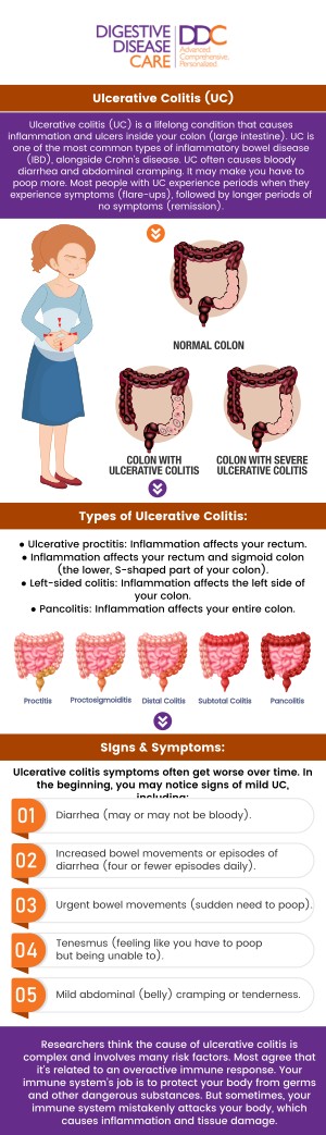 At Digestive Disease Care (DDC), our board-certified gastroenterologists are experts in treating Ulcerative Colitis with a personalized approach. We utilize advanced diagnostic tools and the latest treatment options to manage and alleviate your symptoms. Our dedicated team provides comprehensive care and ongoing support to help you achieve and maintain remission. Trust DDC to deliver compassionate, expert care tailored to your unique needs, ensuring a better quality of life. For more information, please contact us or book an appointment online. We have convenient locations to serve you in Babylon NY, East Setauket NY, Forest Hills NY, Jericho NY, Lake Success NY, Melville NY, Mineola NY, Massapequa NY, New Hyde Park NY and Riverhead NY.