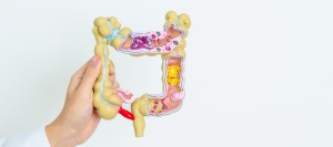 Colon Cancer Screening Specialist Near Me in Forest Hills, NY Colon Cancer Screening Specialist Near Me in Forest Hills, NY