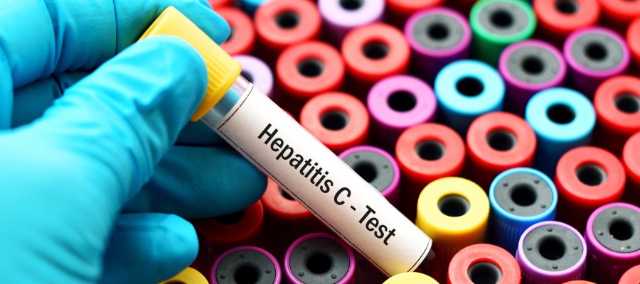 Hepatitis C Treatment Specialist Near Me in Babylon NY, East Setauket NY, Forest Hills NY, Jericho NY, Lake Success NY, Melville NY, Mineola NY, Massapequa NY, New Hyde Park NY, and Riverhead NY