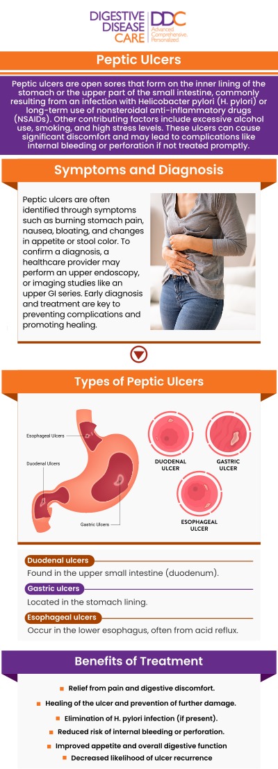 Peptic ulcerative disease refers to open sores that develop on the lining of the stomach, small intestine, or esophagus. It is commonly caused by an infection with Helicobacter pylori bacteria or the long-term use of nonsteroidal anti-inflammatory drugs (NSAIDs). Dr. Mejdi Ahmad, MD, and our board-certified team at Digestive Disease Care provide expert care to diagnose and treat this condition, helping manage symptoms and promote healing. For more information, contact us today or schedule an appointment online. We are conveniently located at 750 Old Country Rd, Riverhead, NY 11901.