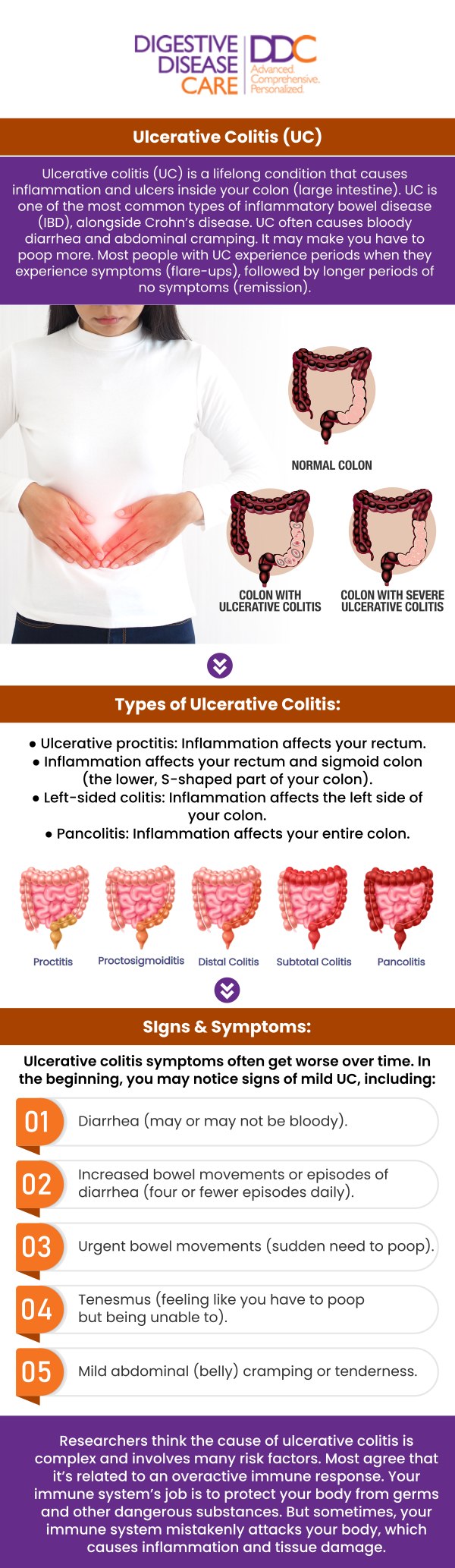 Ulcerative colitis is an inflammatory bowel disease that causes symptoms such as abdominal pain, cramping, and frequent diarrhea, often with blood or mucus in the stool. Other common signs include weight loss, fatigue, and an urgent need to use the bathroom. If you experience these symptoms, it’s important to consult Dr. Preeti Mehta and our board-certified team of gastroenterologists at Digestive Disease Care for proper evaluation and treatment. For more information, please contact us or book an appointment online. We have convenient locations to serve you in Babylon NY, East Setauket NY, Forest Hills NY, Jericho NY, Lake Success NY, Melville NY, Mineola NY, Massapequa NY, New Hyde Park NY and Riverhead NY.