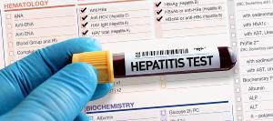 Understanding the Causes of Hepatitis C | Digestive Disease Care Near Me in Babylon NY, East Setauket NY, Forest Hills NY, Jericho NY, Lake Success NY, Melville NY, Mineola NY, Massapequa NY, New Hyde Park NY and Riverhead NY Understanding the Causes of Hepatitis C | Digestive Disease Care Near Me in Babylon NY, East Setauket NY, Forest Hills NY, Jericho NY, Lake Success NY, Melville NY, Mineola NY, Massapequa NY, New Hyde Park NY and Riverhead NY