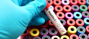 Symptoms of Hepatitis C | Digestive Disease Care Near Me in Babylon NY, East Setauket NY, Forest Hills NY, Jericho NY, Lake Success NY, Melville NY, Mineola NY, Massapequa NY, New Hyde Park NY and Riverhead NY