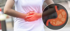 Excessive Burping Treatment in Massapequa, NY